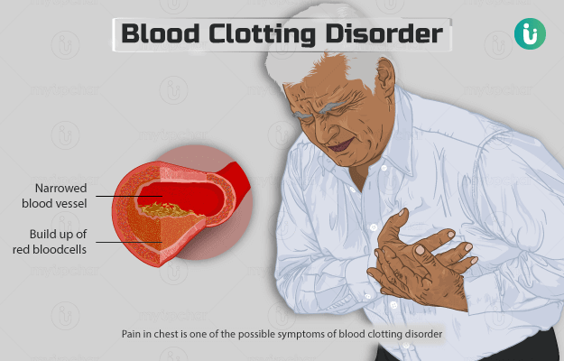 Blood Clotting Disorders