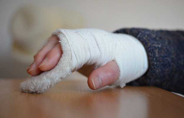 Fractured Hand