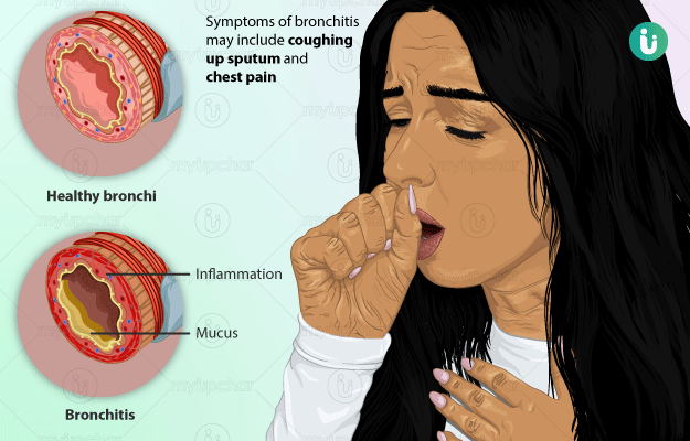 Bronchitis Symptoms Causes Treatment Medicine Prevention Diagnosis