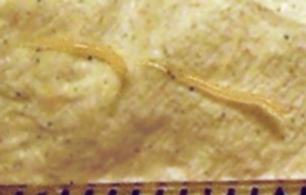 Platyhelminthes flatworms példák - Különbség a Platyhelminthes és a Nematoda között