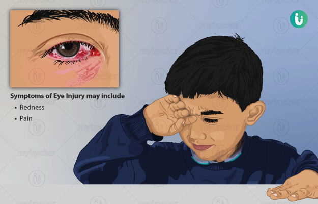 Eye Injury