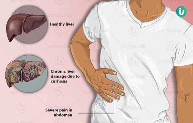 Liver Cirrhosis Meaning In Hindi Rima1