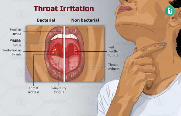 Itchy Throat