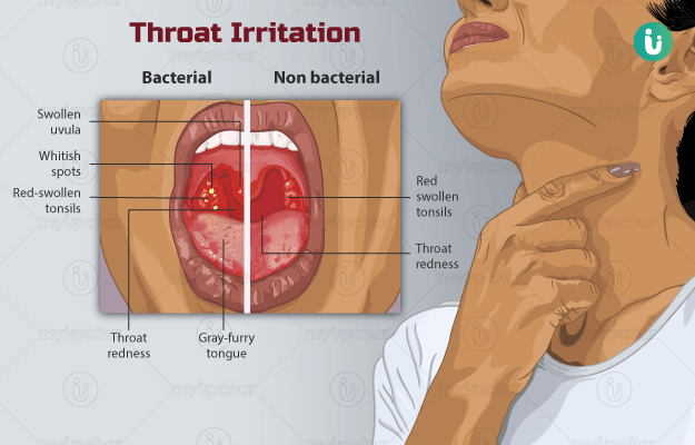 Itchy Throat Symptoms Causes Treatment Medicine Prevention Diagnosis