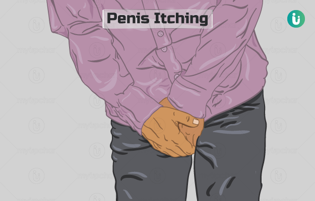 Itching in penis: symptoms, causes, prevention, diagnosis, treatment