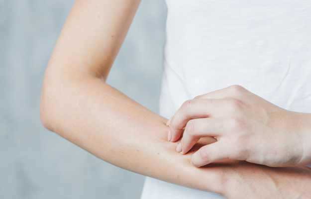 Burning sensation on skin: symptoms, causes, prevention, diagnosis,  treatment