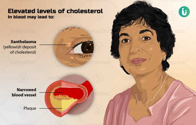 High Cholesterol: symptoms, causes, treatment, medicine, prevention,  diagnosis